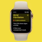 Apple Watch's Innovative AFib Detection Tool Receives FDA Approval